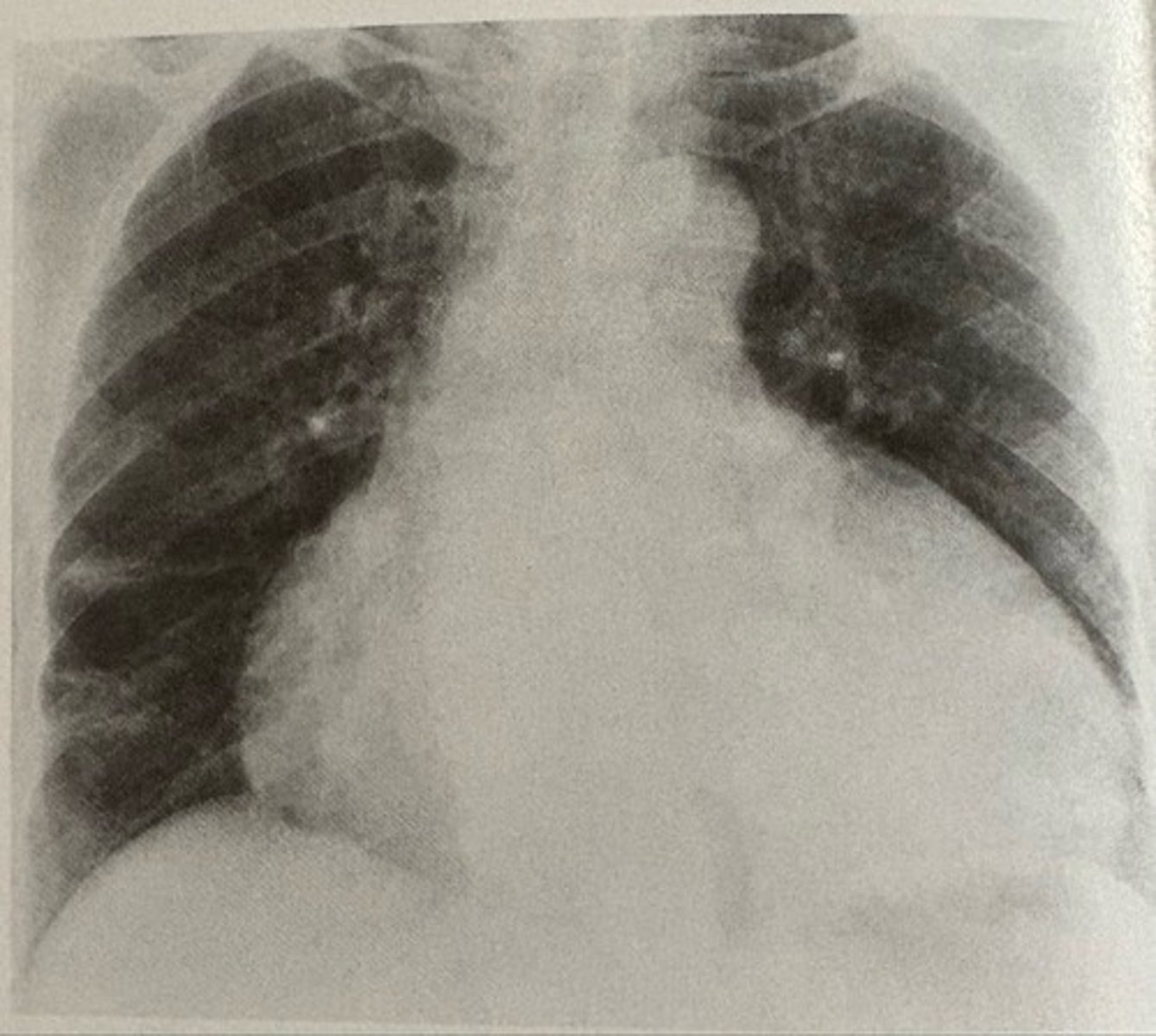 <p>what pathology is present?</p>