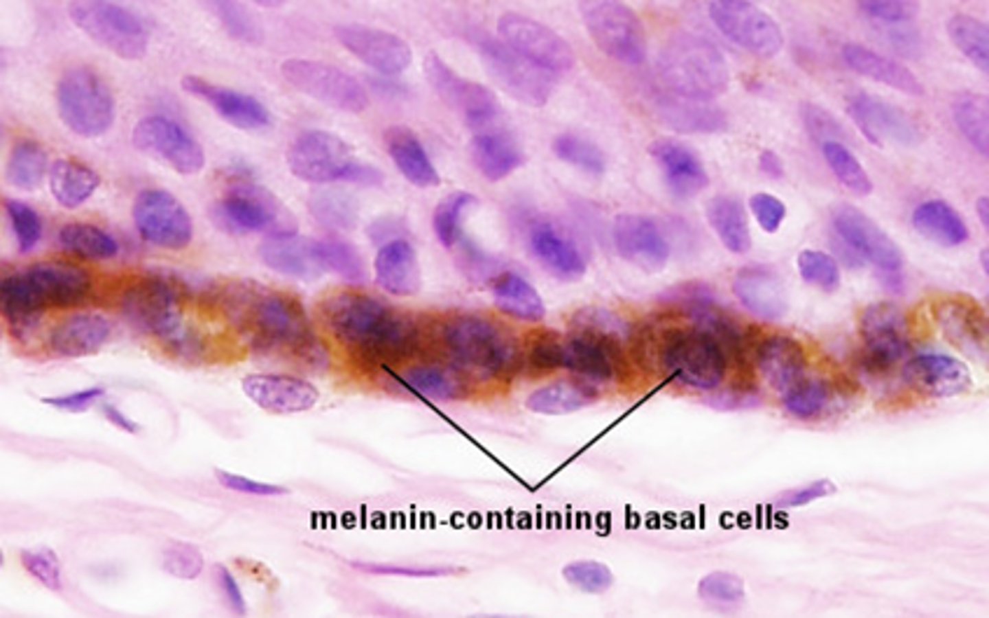 <p>A pigment that gives the skin its color</p>
