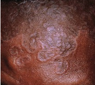 <p>what is this image? </p>