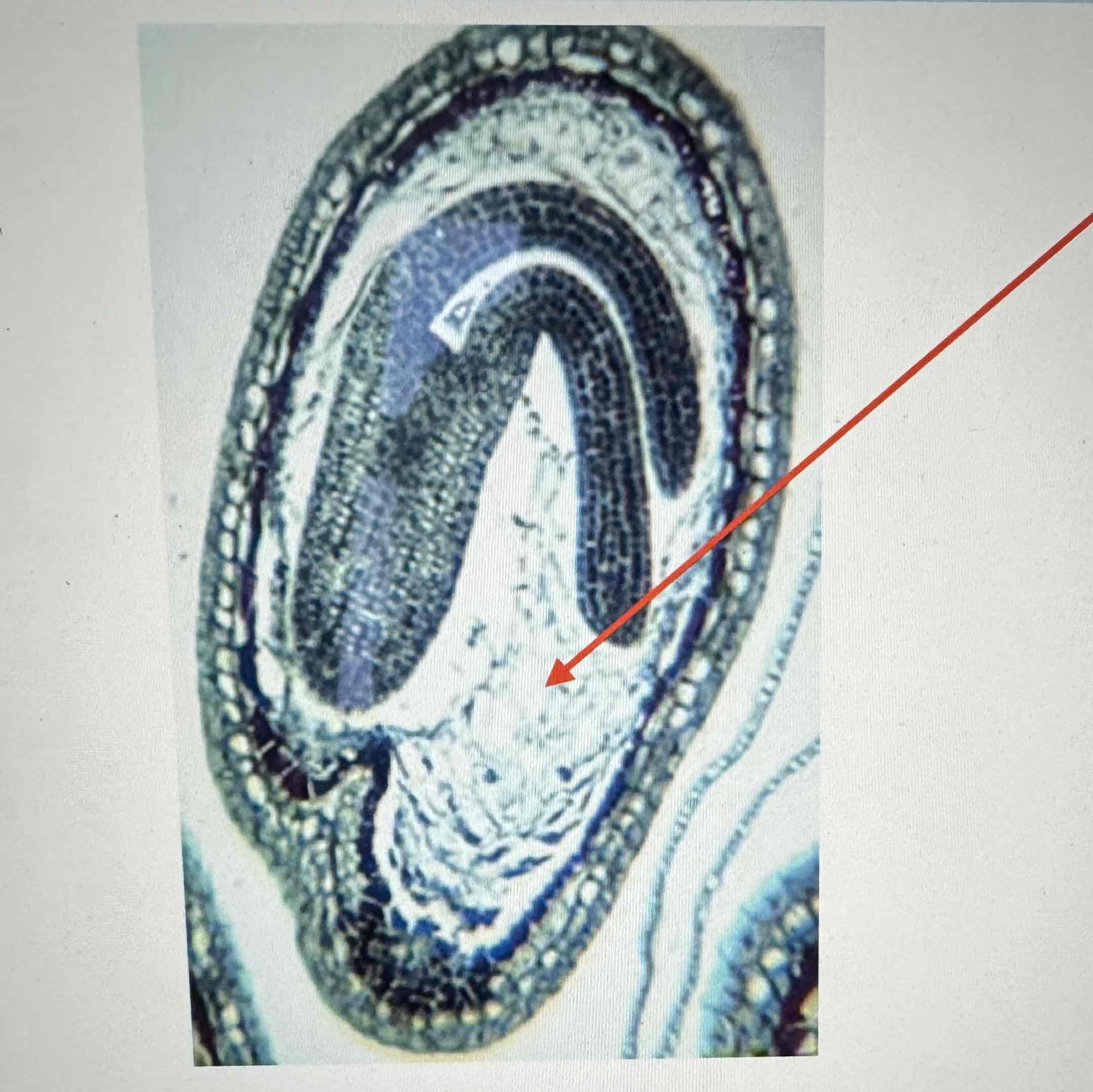 <p>what is the arrow pointing to in this Angiosperm</p>