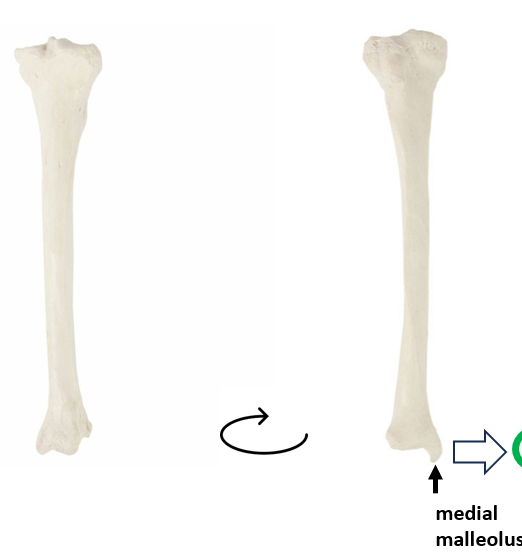 <p>What bone is this?</p>