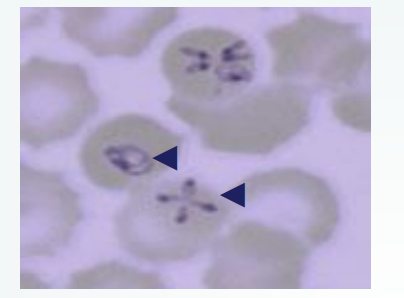 <p>Which protozoan is a pyriform, round, or oval parasite of mammalian RBCs? Trophozoites develop after sporozoites infect the RBCs and merozoites develop as trophozoites mature, resemble four trophozoites, and are attached in a maltese cross formation. It is reportable and is transmitted by ticks.</p>