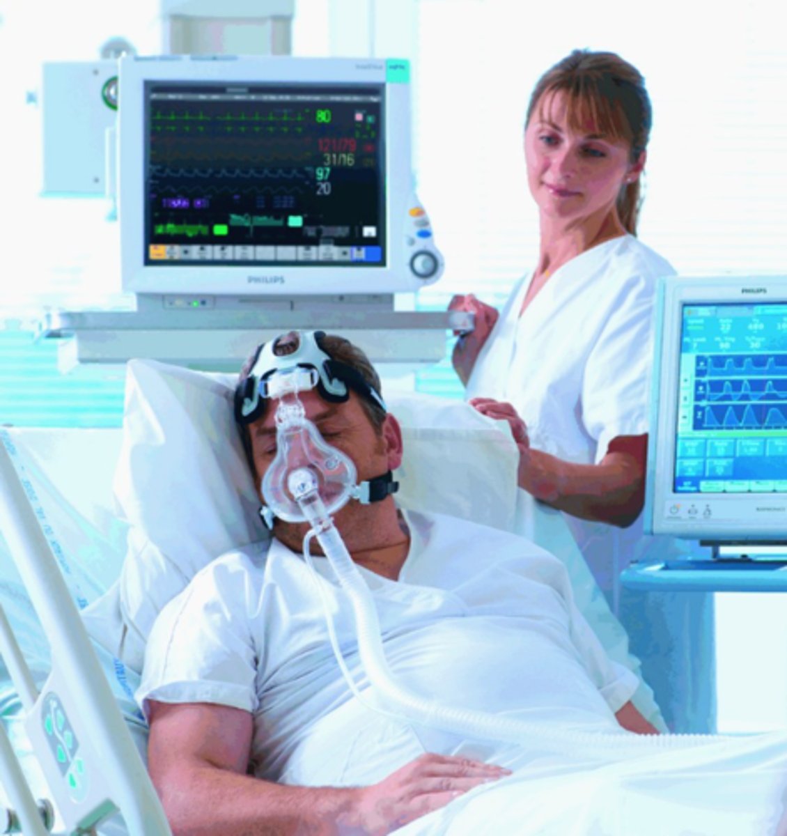 <p>positive end-expiratory pressure - common mechanical ventilator setting in which airway pressure is maintained above atmospheric pressure</p>
