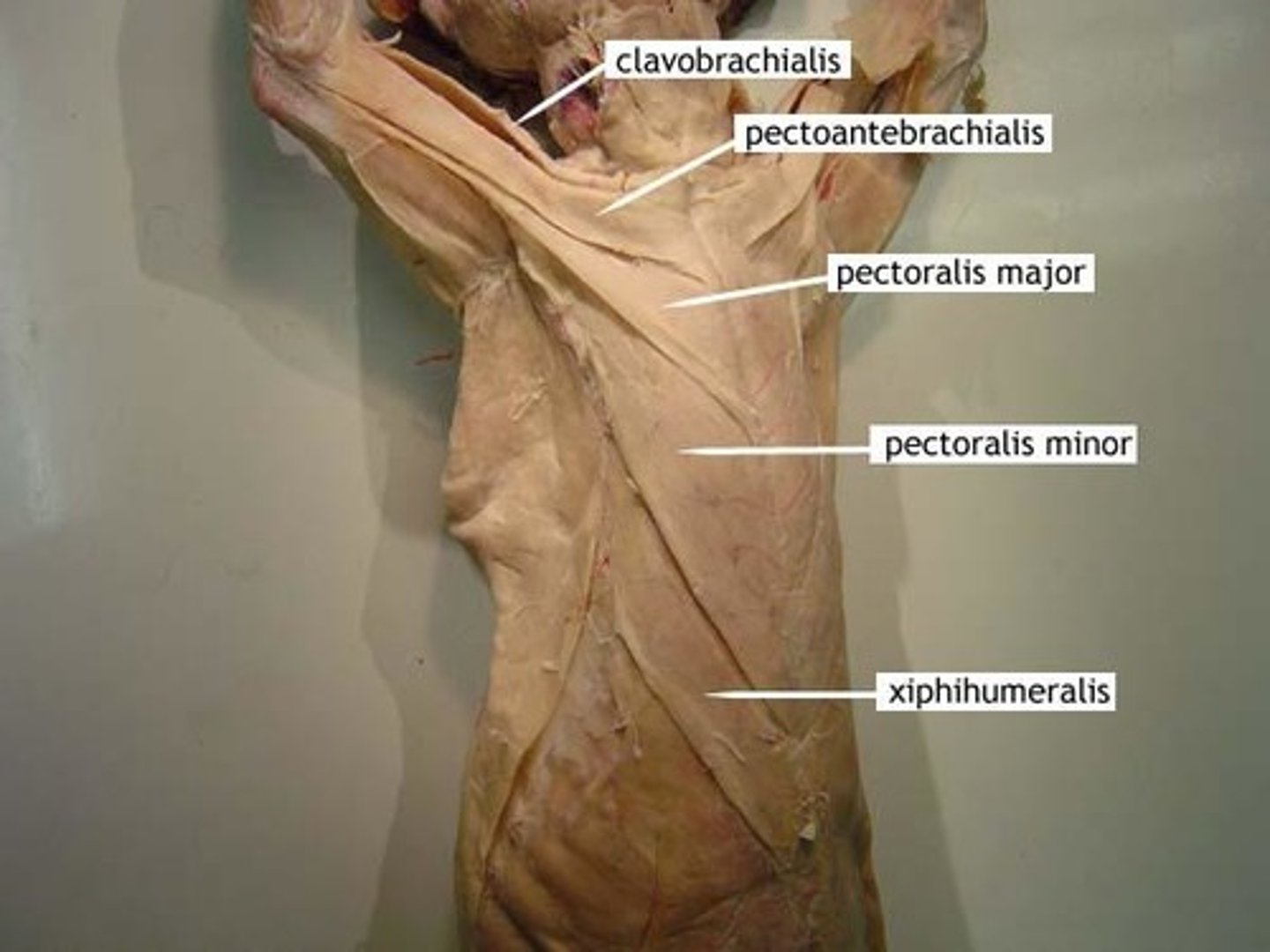 <p>-below pectoantebrachialis</p><p>-largest in man, but not in cat</p><p>--originates- anterior part of sternum</p><p>-inserts- fascia of ulna</p><p>-function: Draws forelimb towards the midline and turns the manus forward</p>