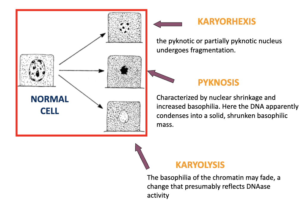 <p>Type of nuclear change where pyknotic nucleus undergoes fragmentation</p>