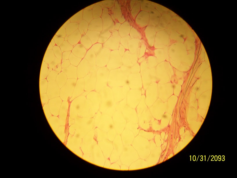 <p>Adipose tissue</p>