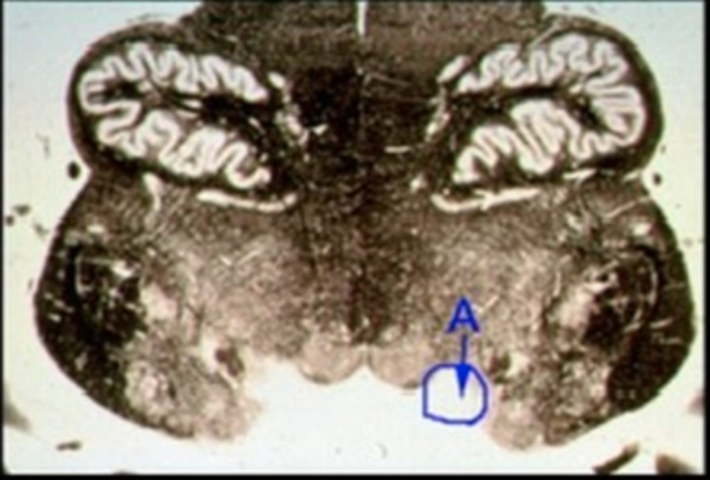 <p>Identify the structure indicated by the outline and letter "A."</p>