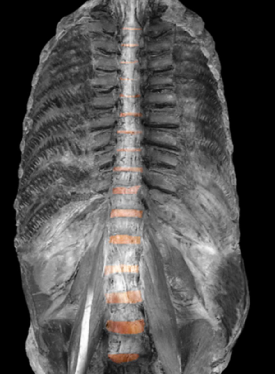 <p>shock absorber</p>