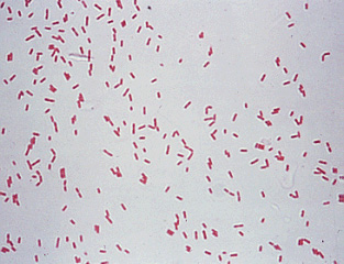 Pseudomonas aeruginosa