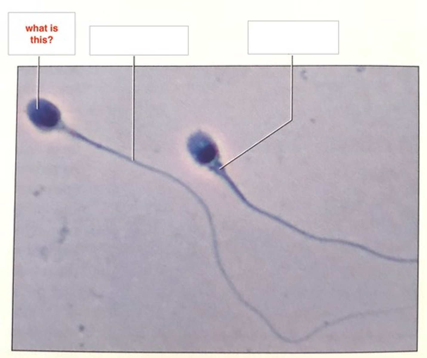<p>head w/ acrosome</p><p>midpiece</p><p>flagellum</p>