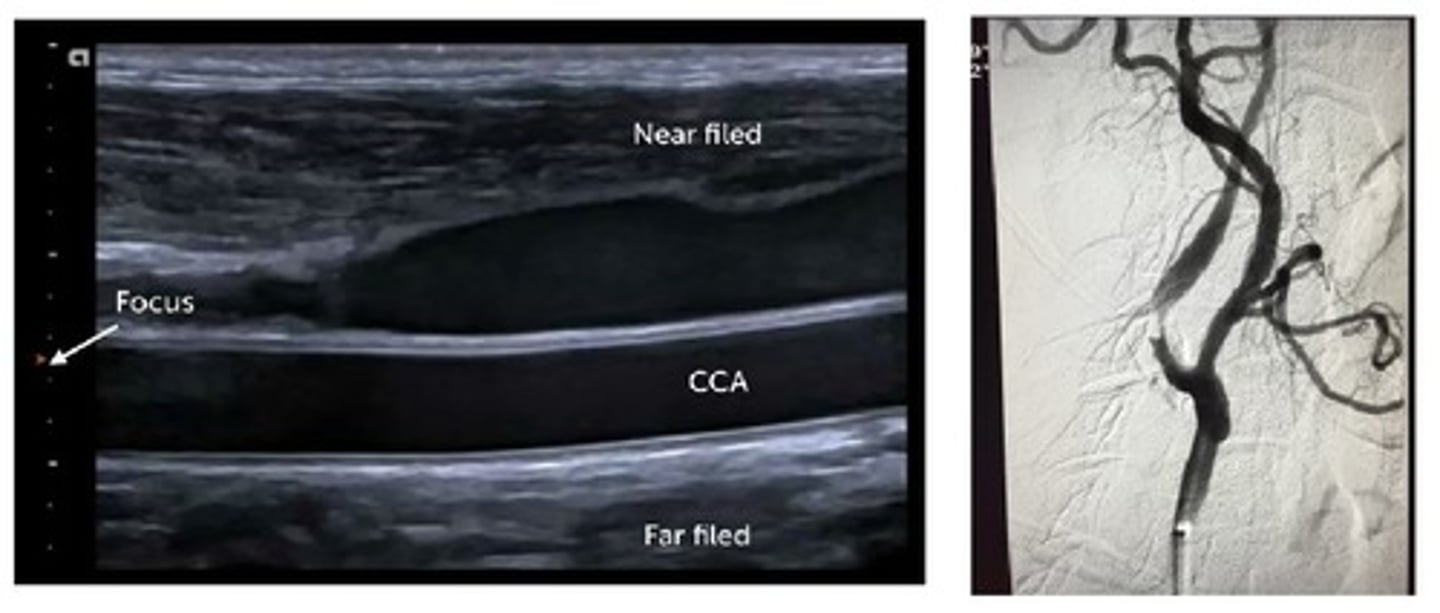 <p>angiography; 100%</p>