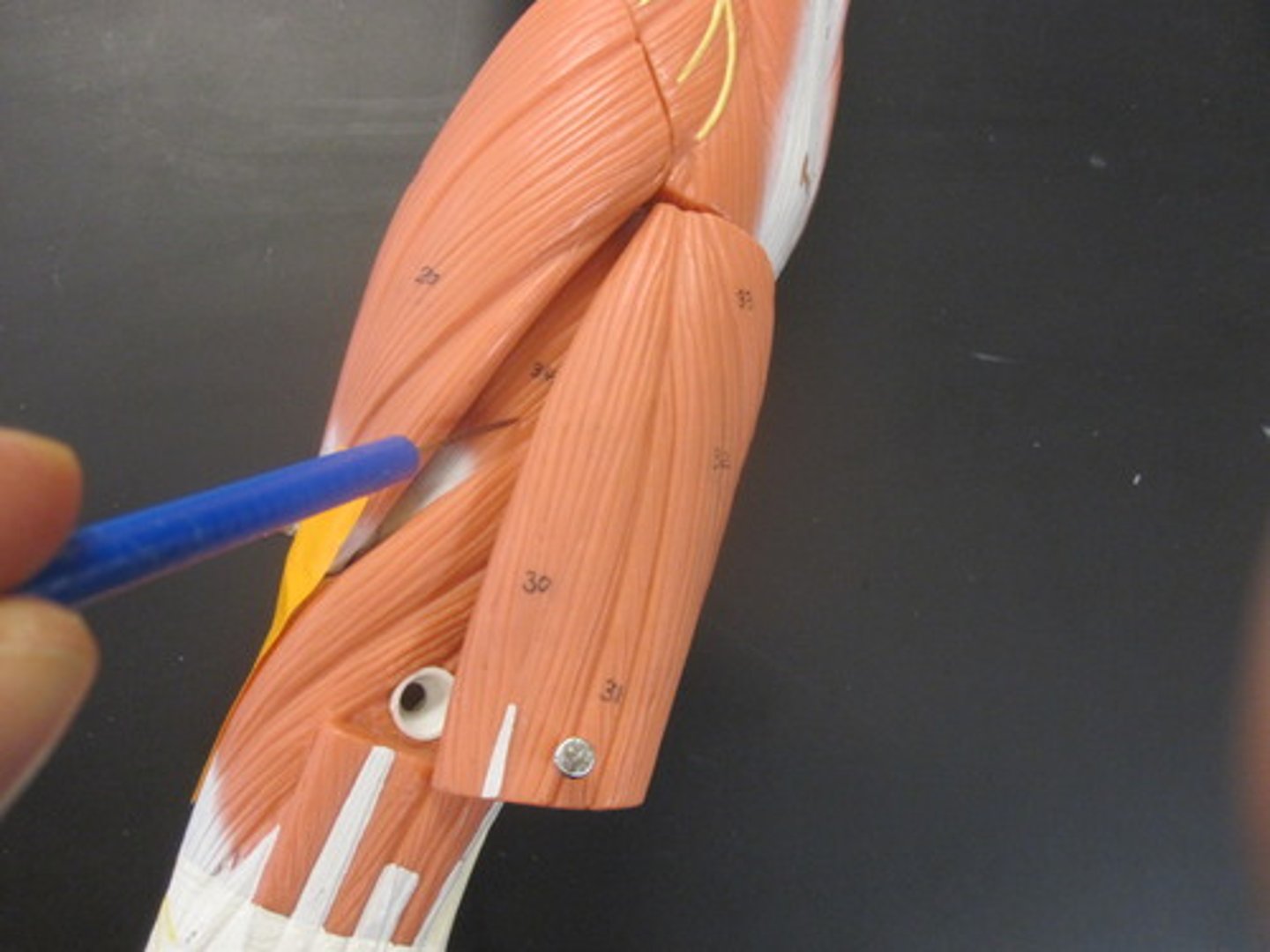 <p>A muscle that supinates the forearm.</p>