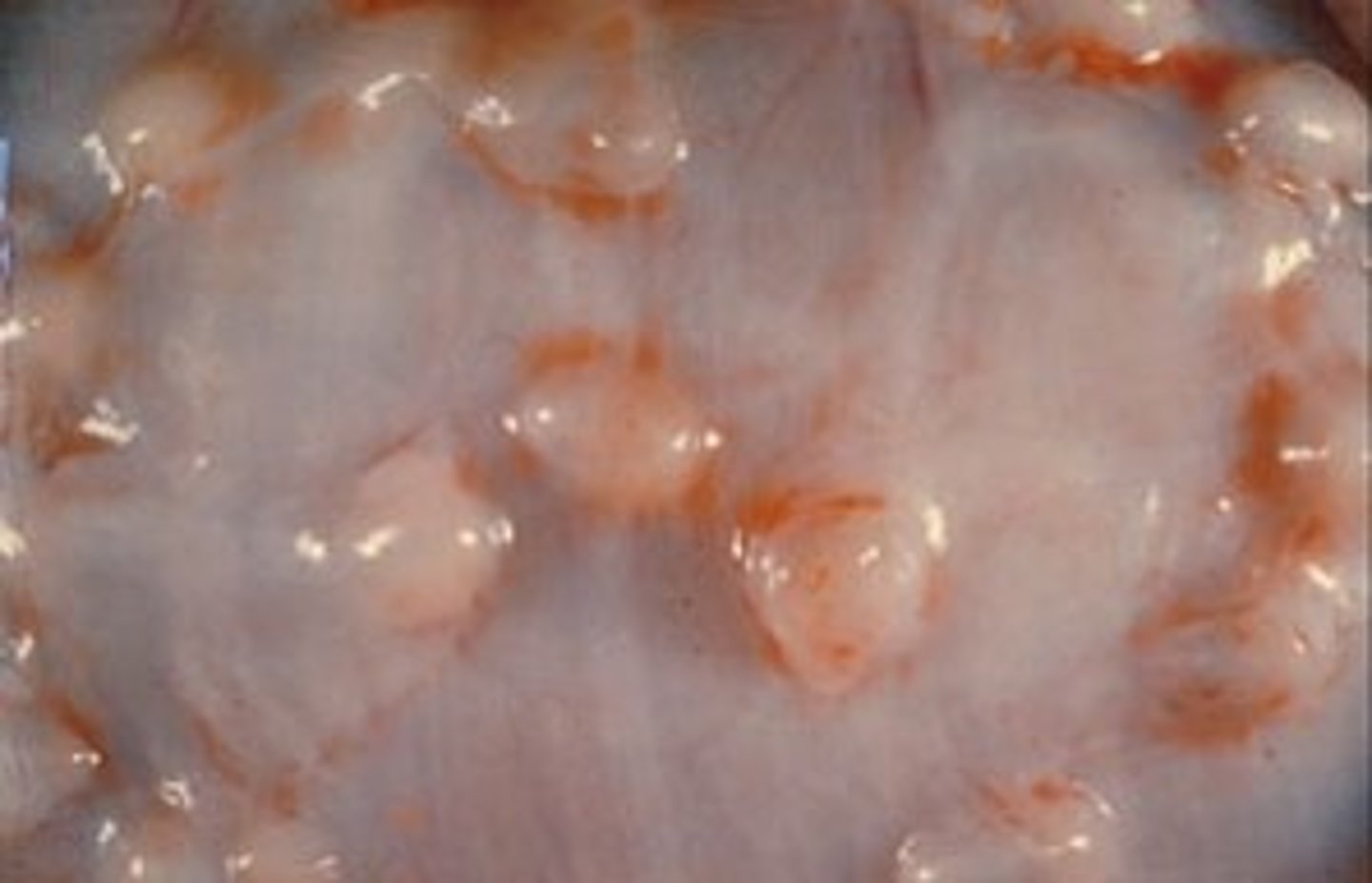 <p>What parasites are associated with the nodules in the image of the intestine of this necropsied pig?</p>