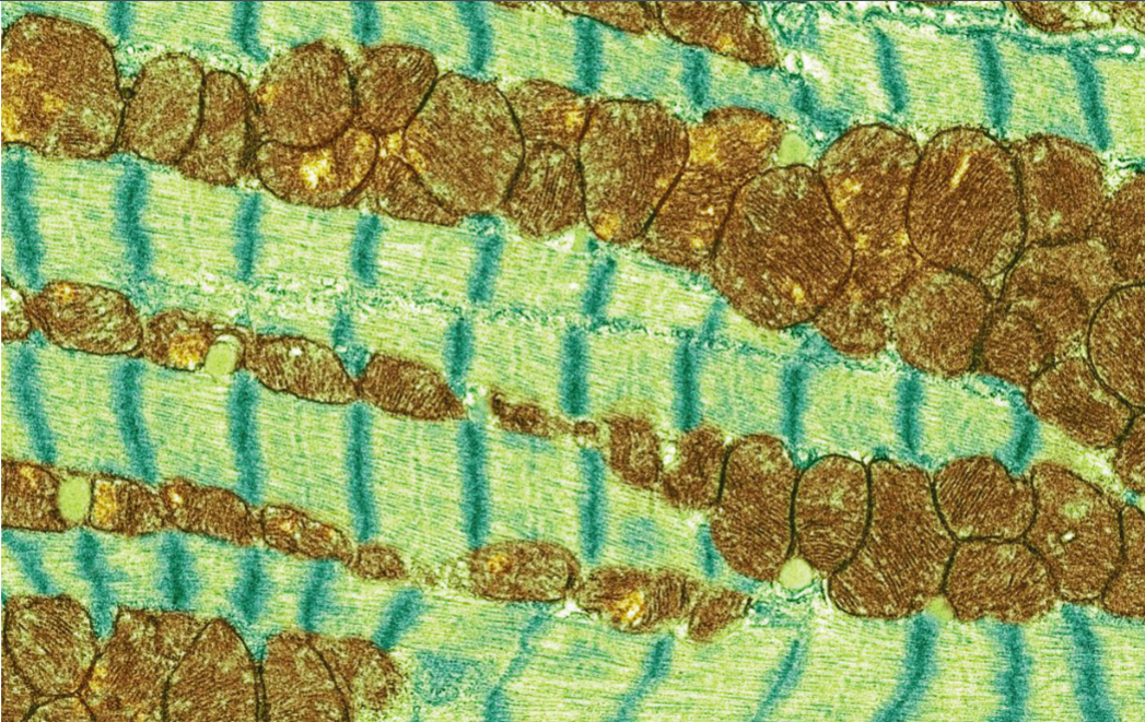 <p>What is the brown stuff in this muscle cell</p>