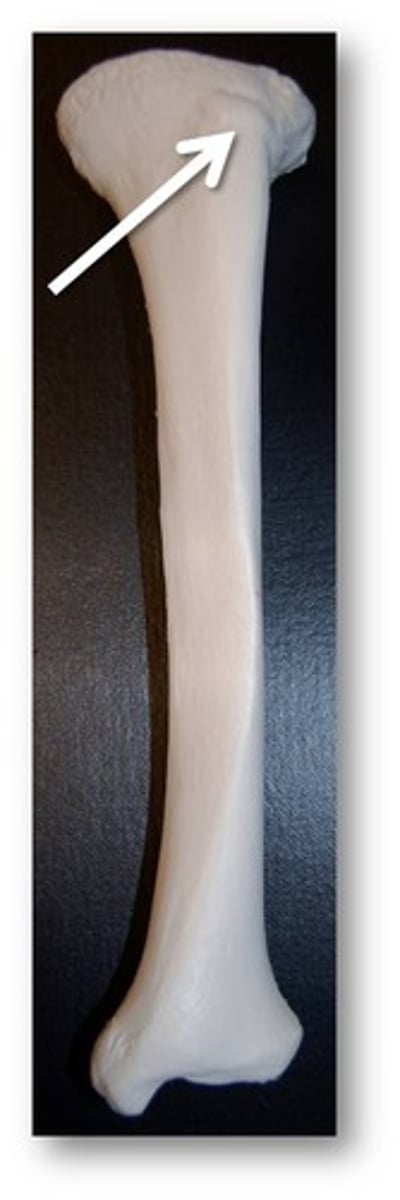 <p>Large rounded projection; may be roughened</p>