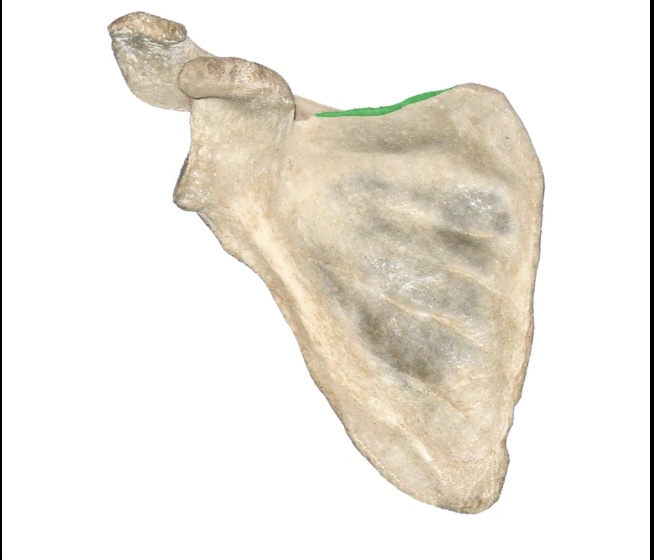 <p>what part of the scapula is this?</p>