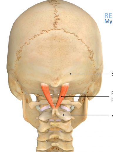 <p>Origin: Spinous process of the axis (C02)</p><p>Insertion: Lateral part of the inferior nuchal line of the occipital bone</p><p>Innervation: Posterior primary division of the spinal nerves (dorsal ramus of C01)</p><p>Action: Extension of the neck and spine; ipsilateral rotation of the head (turning the</p>