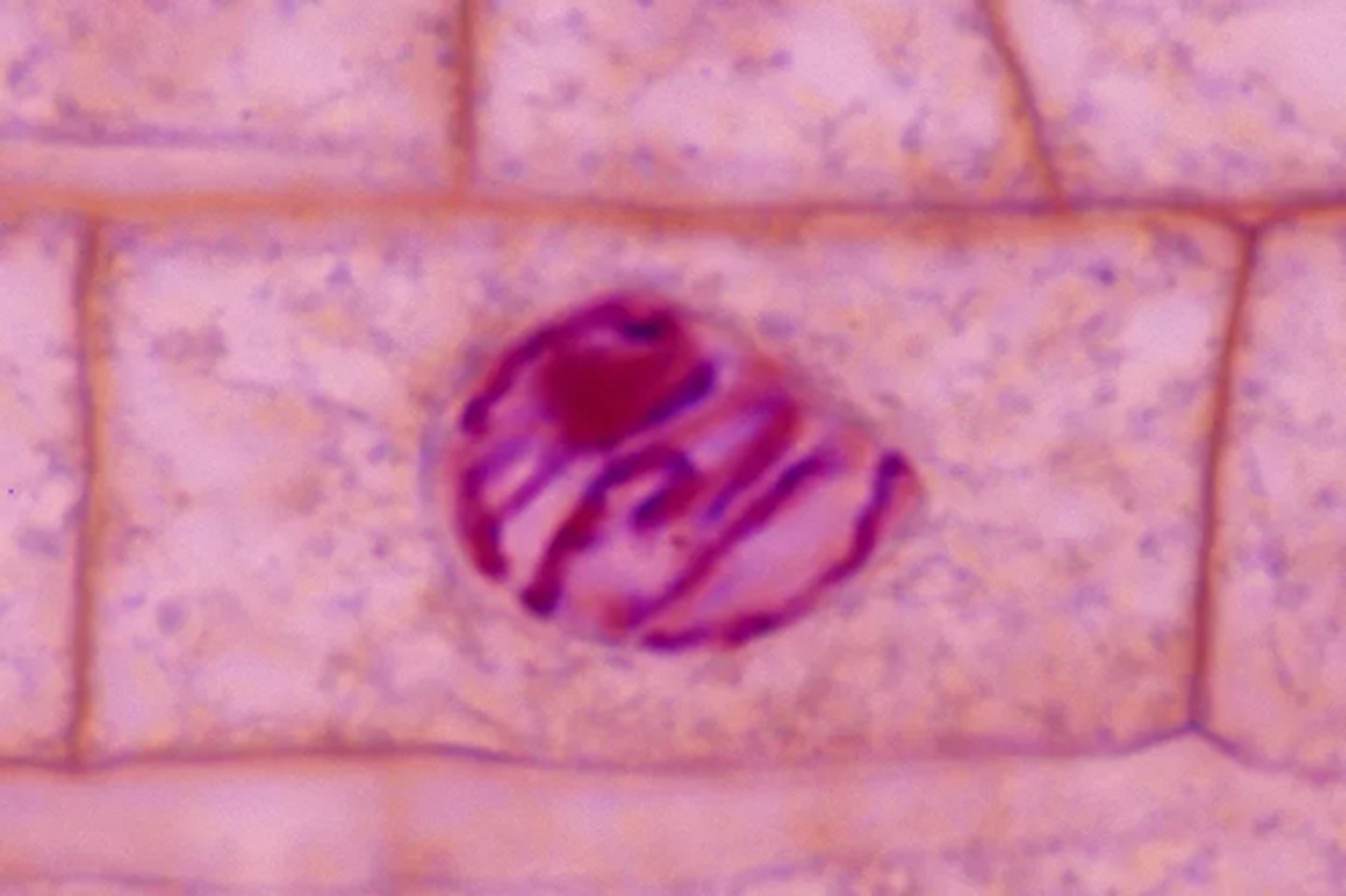 <p>First stage of mitosis; chromatin condenses into chromosomes (2 sister chromatids), nucleolus breaks down, spindle fibers form from centrioles (which move to opposite poles), and nuclear envelope dissolves</p>