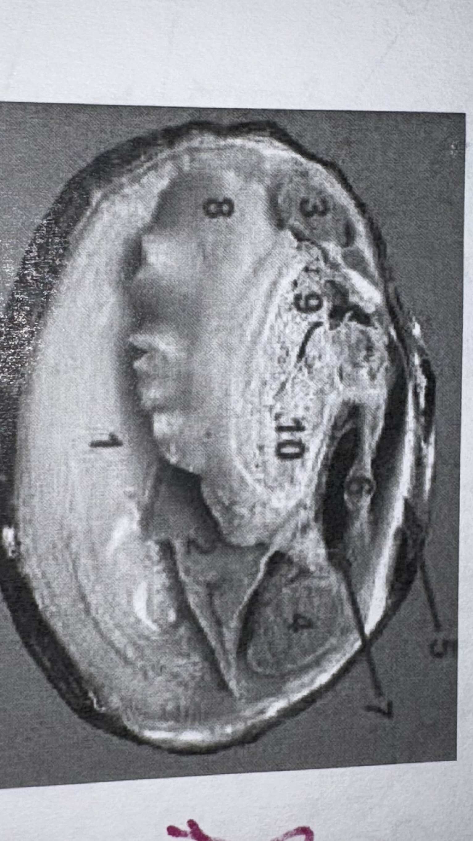 <p>label 1 on the clam </p>