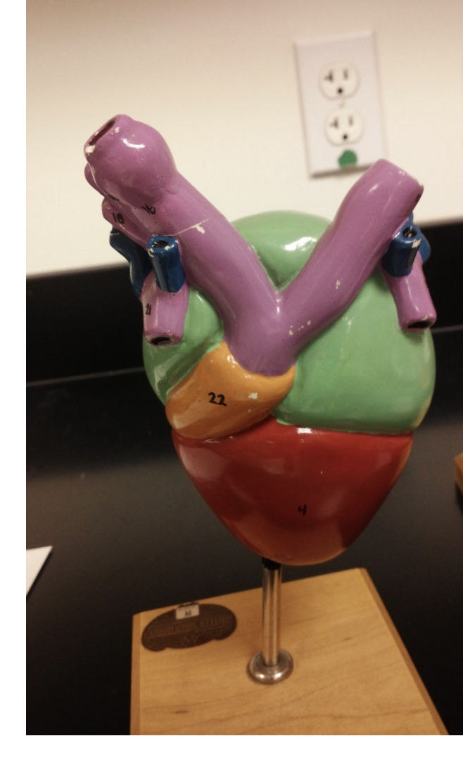 <p>What kind of heart is this? </p>