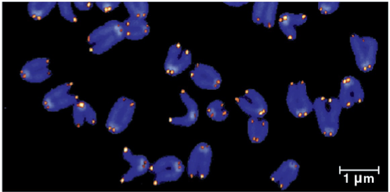 <p>telomeres </p>