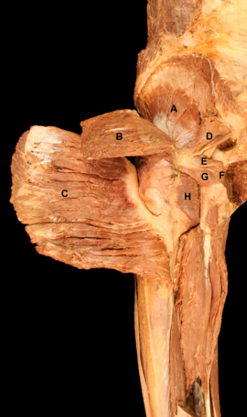 <p>E</p>