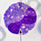<p>what type of blood cell is this?</p>