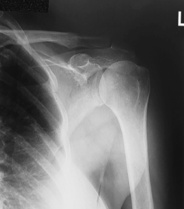 <p>name the position/projection</p>