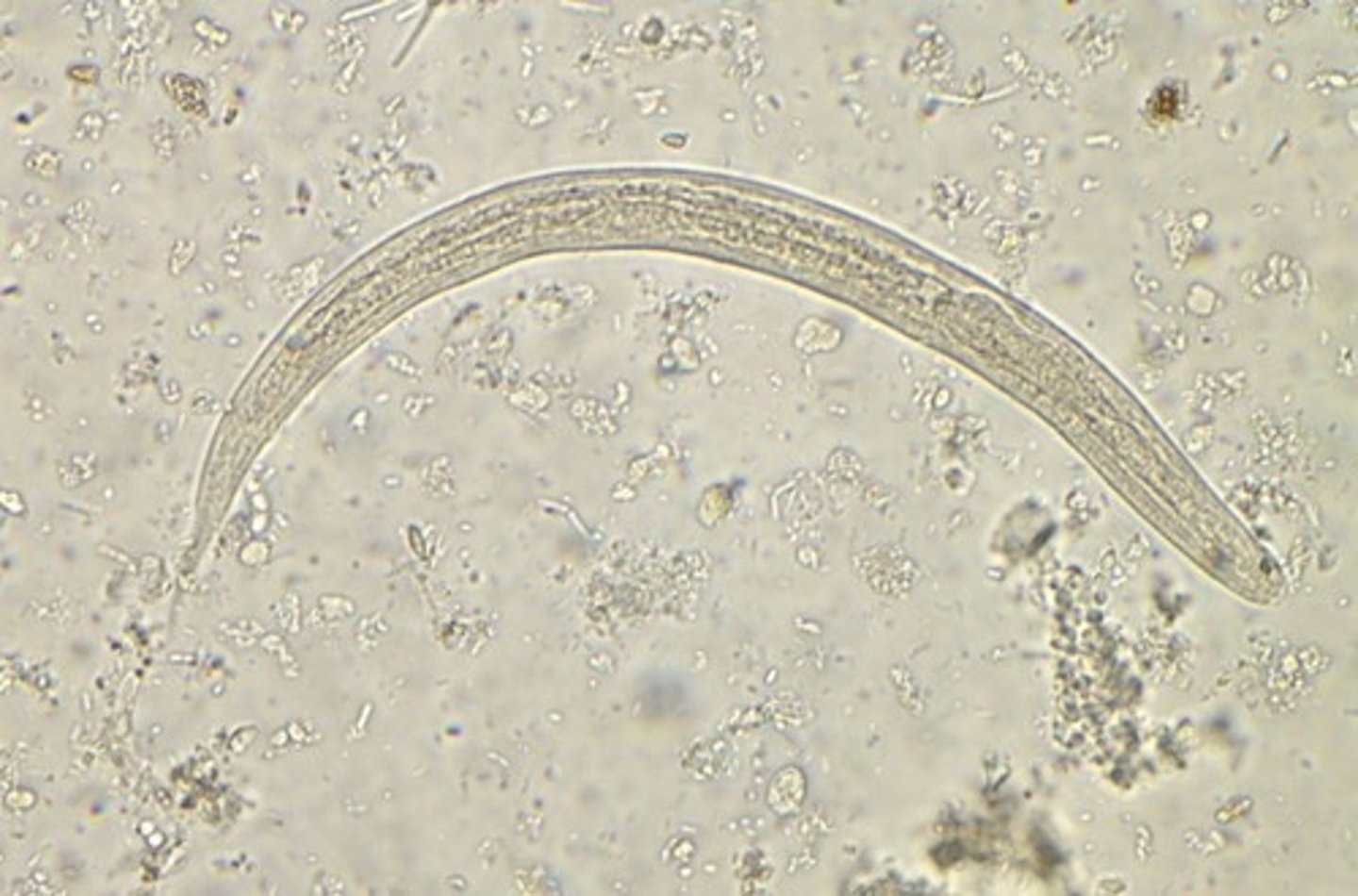 <p>Female: 2x0.04mm</p><p>Colorless</p>