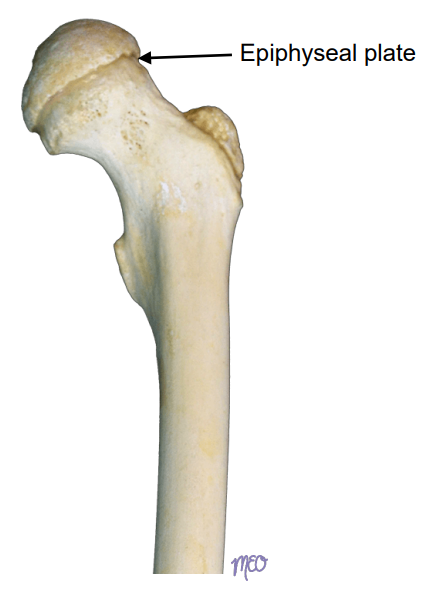 <p>Bones are joined by<strong><u> hyaline cartilage</u></strong>, such as <strong>epiphyseal plates</strong> (temporary)</p>