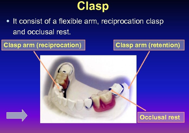 <ul><li><p>types of direct retainer </p></li><li><p>component of clasp assembly that provides reciprocation by engaging reciprocal guiding planes which are known as reciprocal clasp arm </p></li><li><p>It contacts the action of clasp during removal and insertion of a a partial removable dental prosthesis </p></li></ul><p></p>