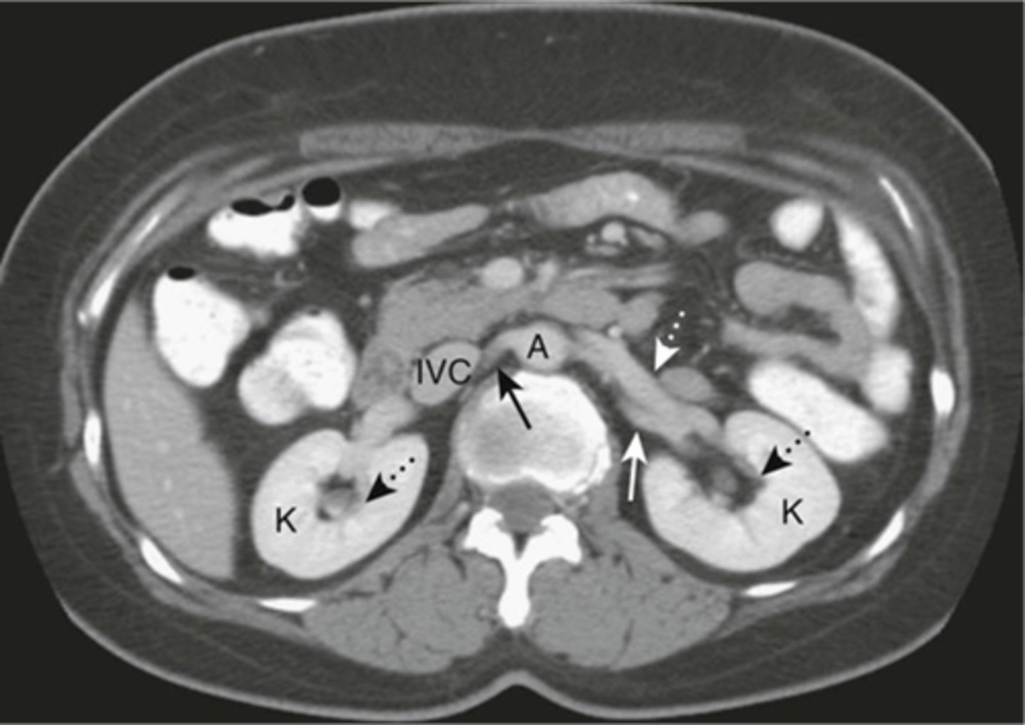 knowt flashcard image