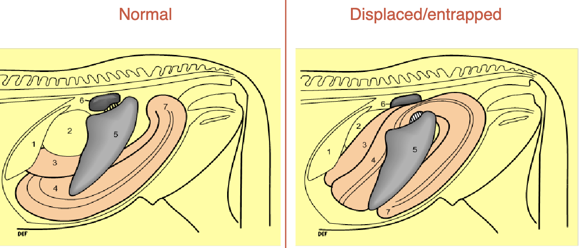 <p>left dorsal displacement is aka</p>
