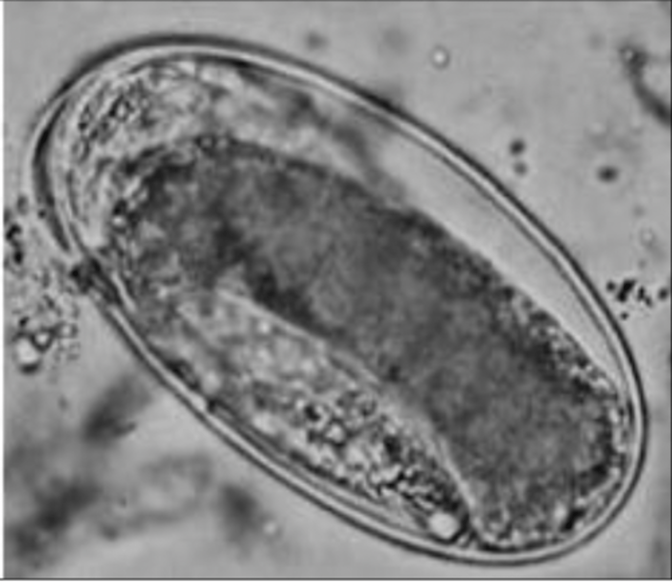 <p>What egg does this parasite belong to? It was measured to be 90 microns</p>