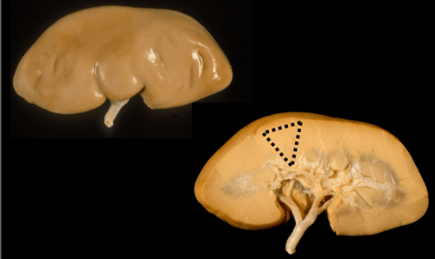 <p>external lobes less present, papillae present</p>