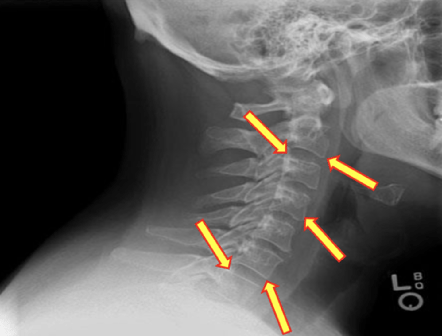 <p>What are the yellow arrows pointing to?</p>