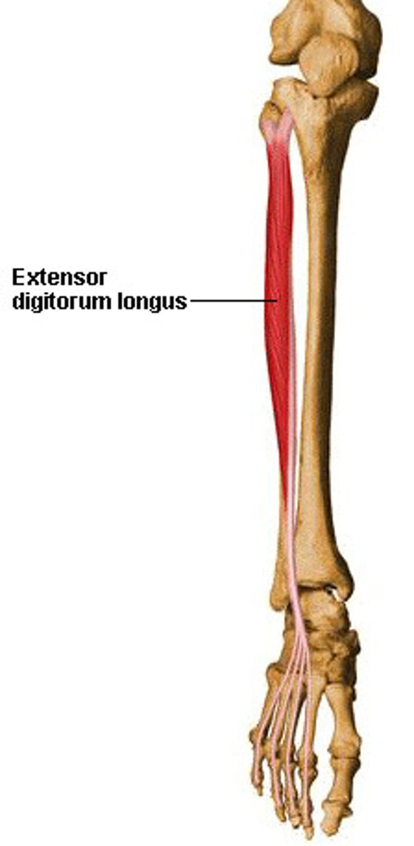 <p>-Origin Anterior lateral condyle of tibia, anterior shaft of fibula and superior 3⁄4 of interosseous membrane</p><p>-Insertion: Dorsal surface; middle and distal phalanges of lateral four digits</p><p>-Nerve deep fibular nerve</p><p>-Actions</p><p>=extension of toes</p><p>=dorsiflexion of ankle</p><p>-Antagonist Flexor digitorum longus, Flexor digitorum brevis</p>