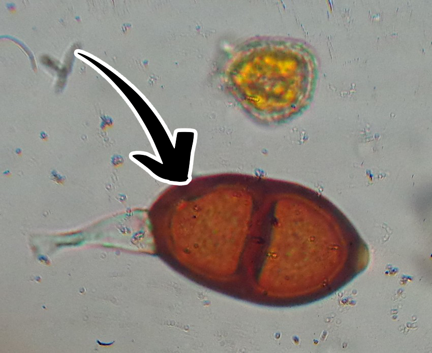 <p>Puccinia graminis: Vad är detta för spor?</p>