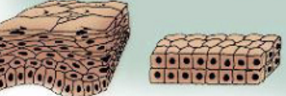 <p>Consists of two or more layers of cells that protect underlying tissues in locations where there is considerable wear and tear</p>