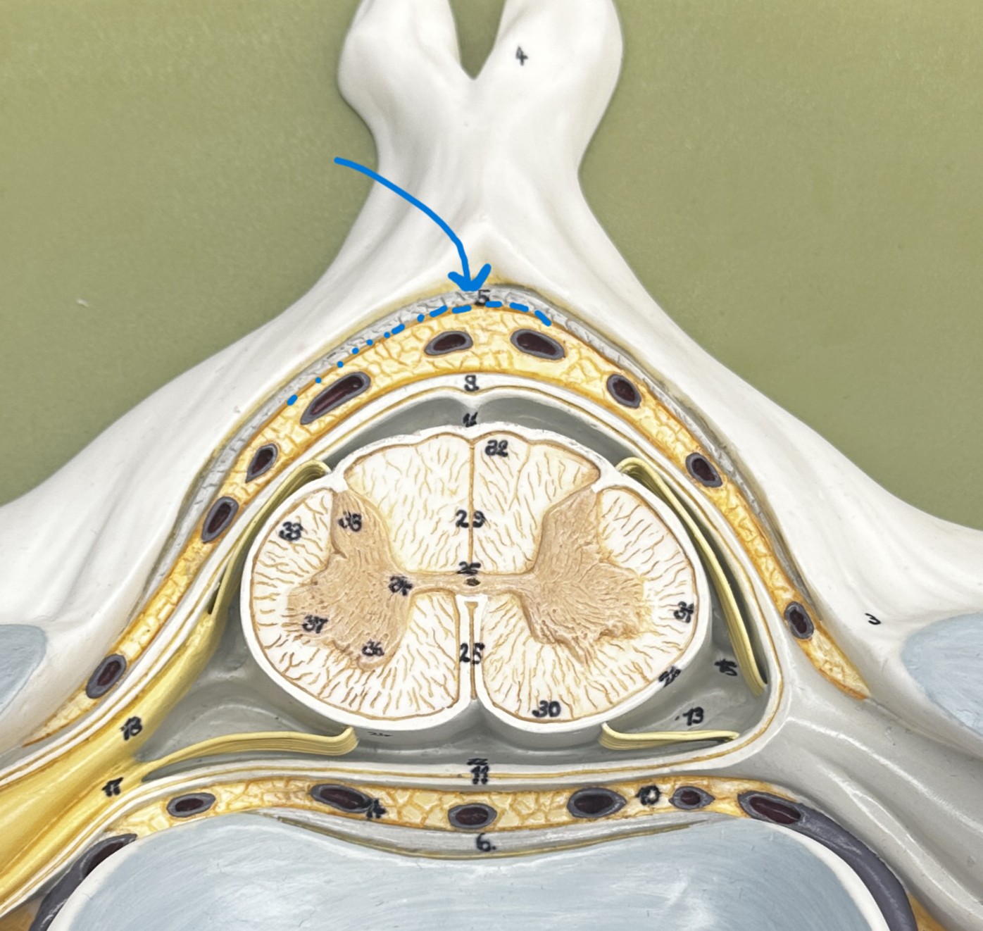 <p>(yellow ligament, not the spongy material)</p>