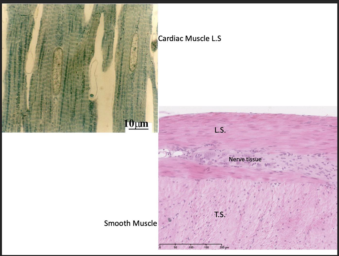 <ul><li><p>elongated</p></li><li><p>with contractile properties</p></li></ul><p>Smooth:</p><ul><li><p>tapered cells + central nuclei</p></li></ul><p>Striated</p><ol><li><p>cardiac</p><ul><li><p>central nucleus</p></li><li><p>intercalated discs</p></li><li><p>Purkinje fibres</p></li><li><p>appear to branch</p></li></ul></li><li><p>Skeletal </p><ul><li><p>peripheral nuclei</p></li><li><p>motor end plates</p></li></ul></li></ol><p></p>