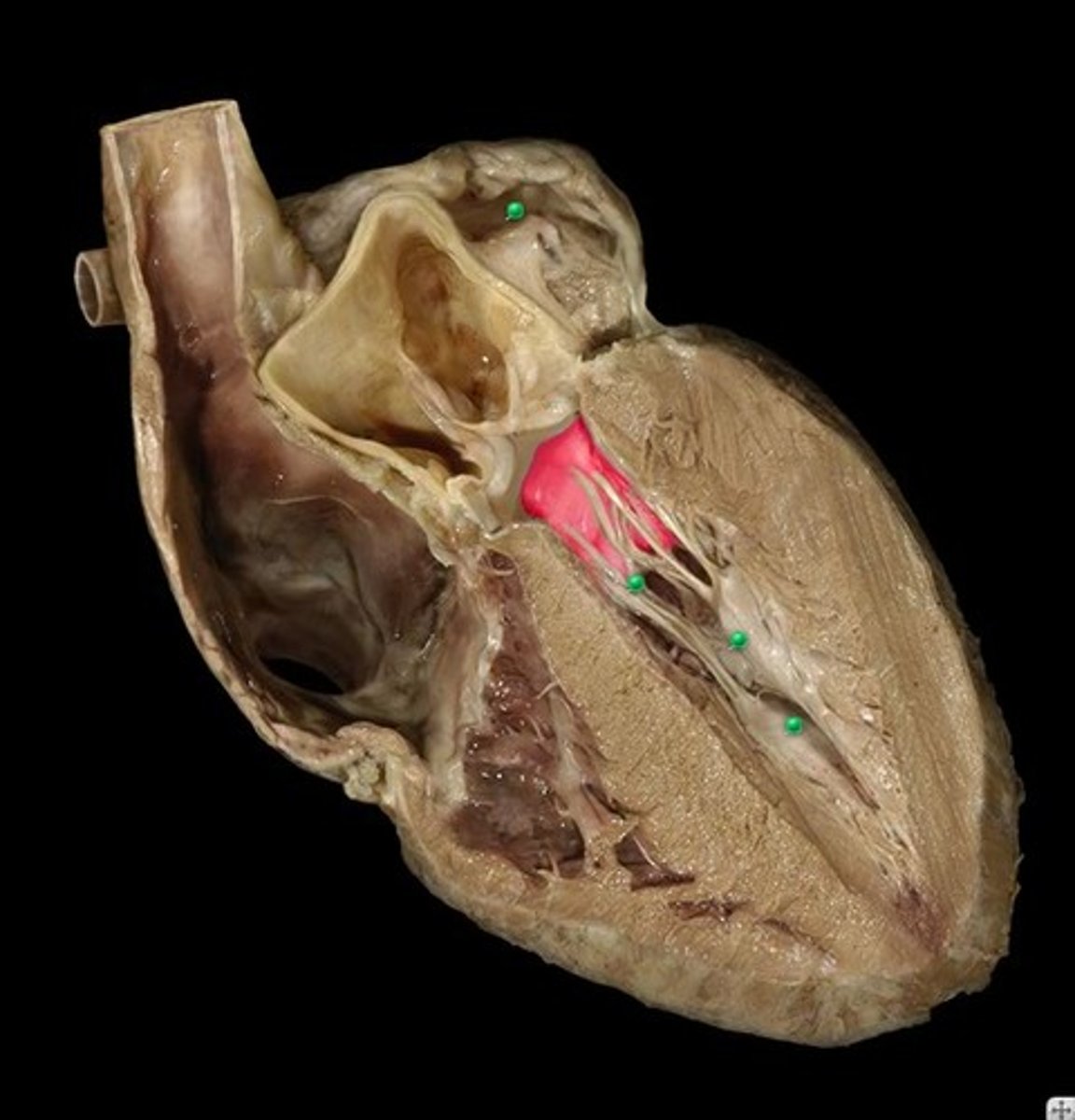 <p>valve between the left atrium and the left ventricle.</p>