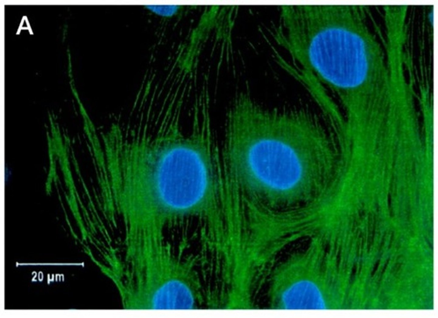 <p>Drug that binds and stabilizes actin filaments.</p><p>Used with a fluorescent dye to visualize actin filaments in a cell</p>