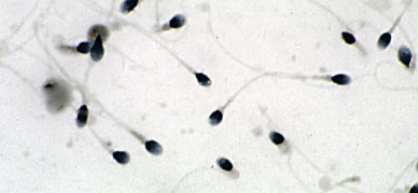 What cell type is this?