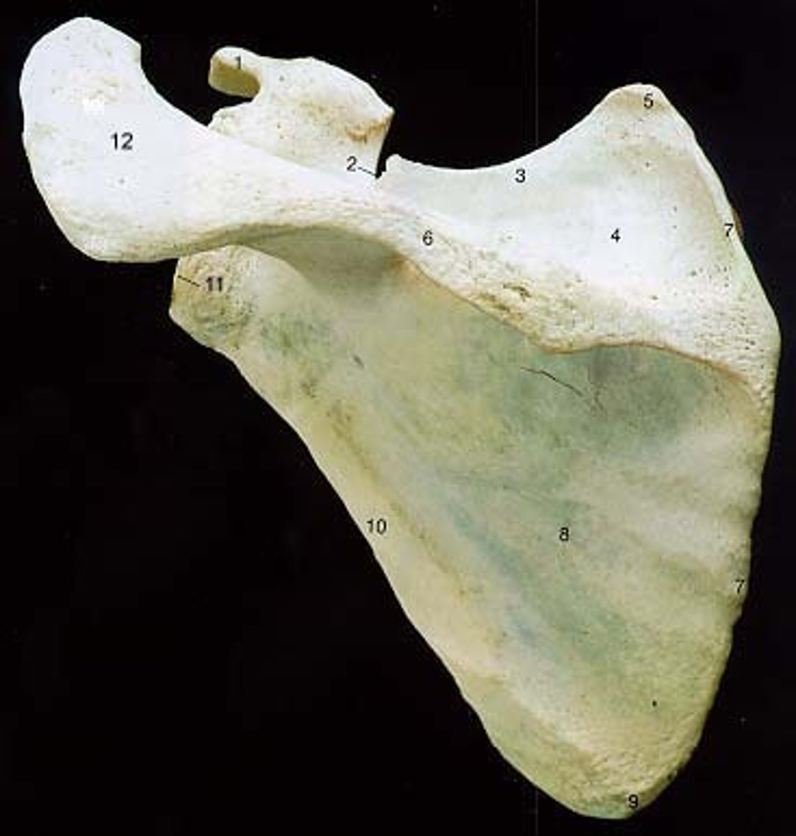 <p>is this a right or left scapula?</p>