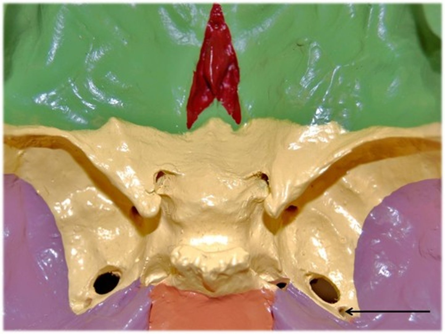 <p>Sphenoid</p>