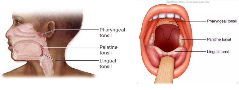 <p>Secondary: Tonsils</p>