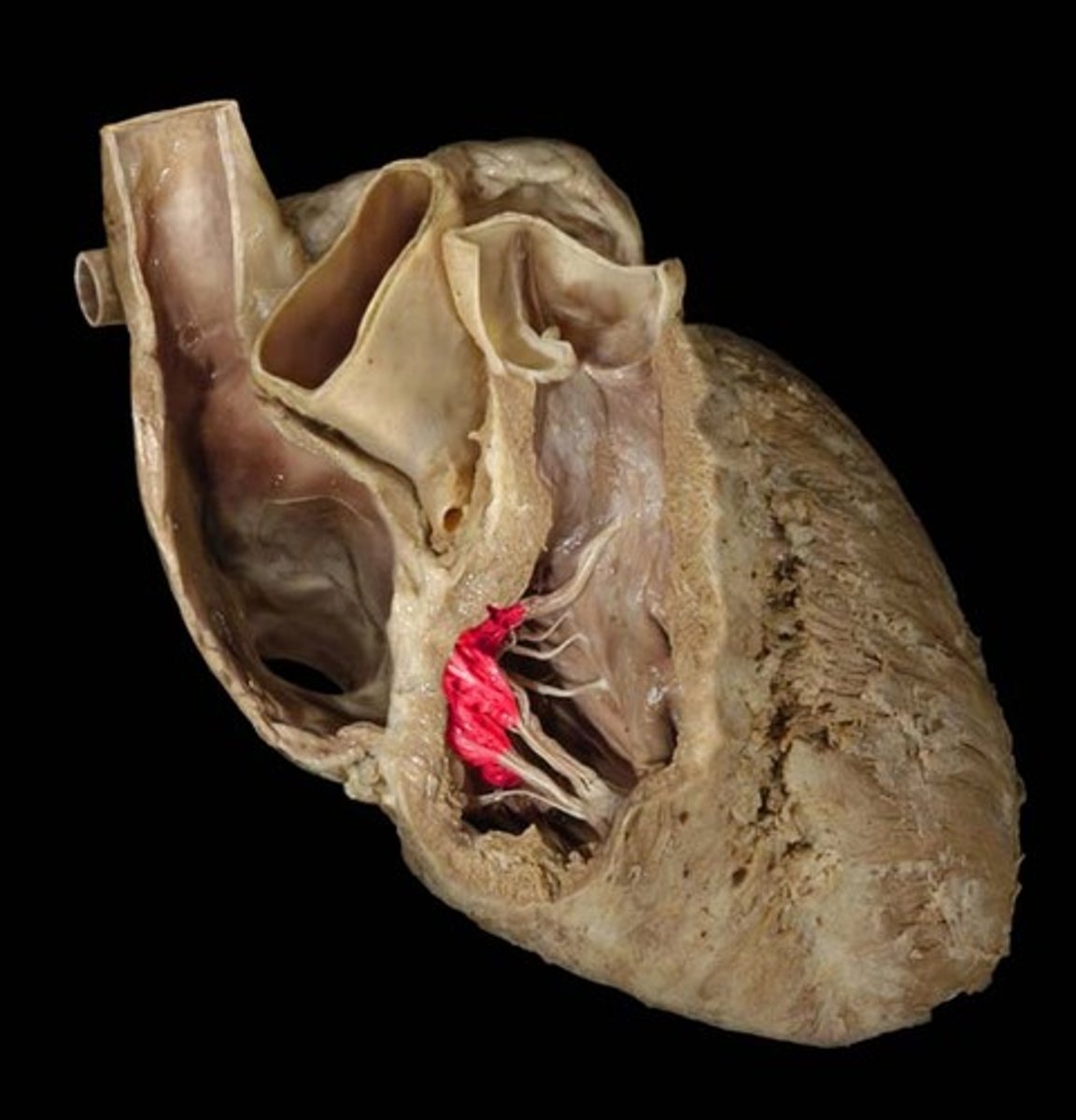 <p>Description: Valve with three cusps between the right atrium and ventricle</p><p>Relationship: Atrioventricular valves are open during ventricular diastole (filling)</p>