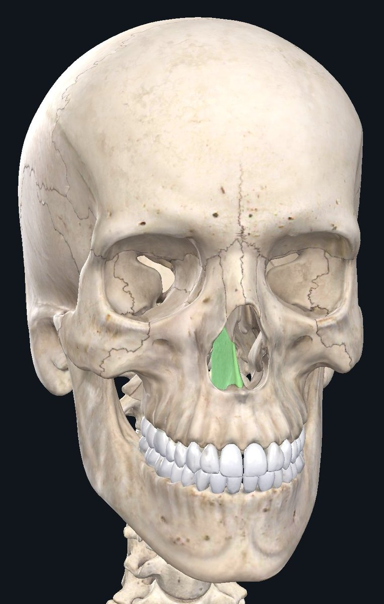 <p>what facial bone is this</p>