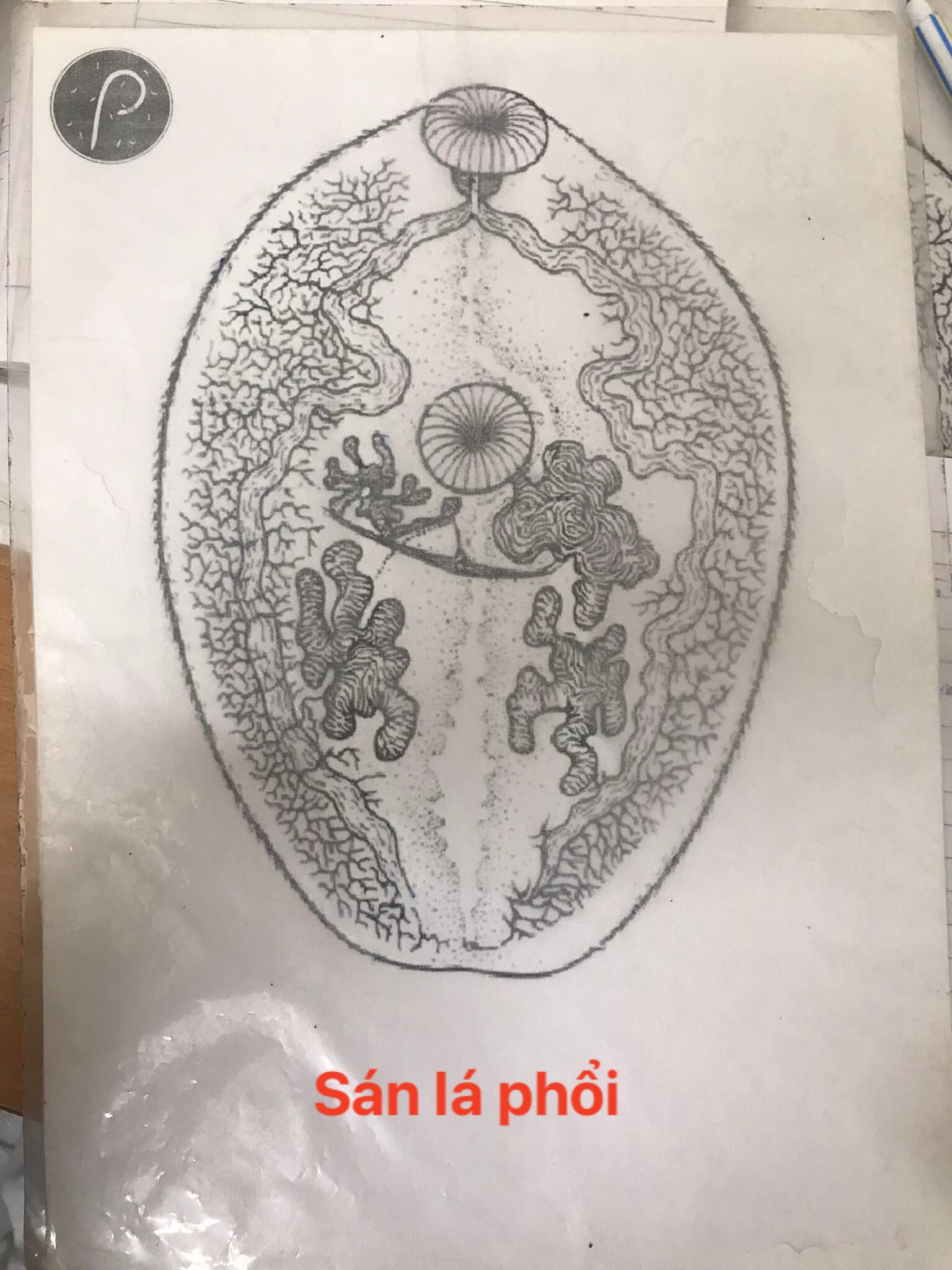 sán lá phổi